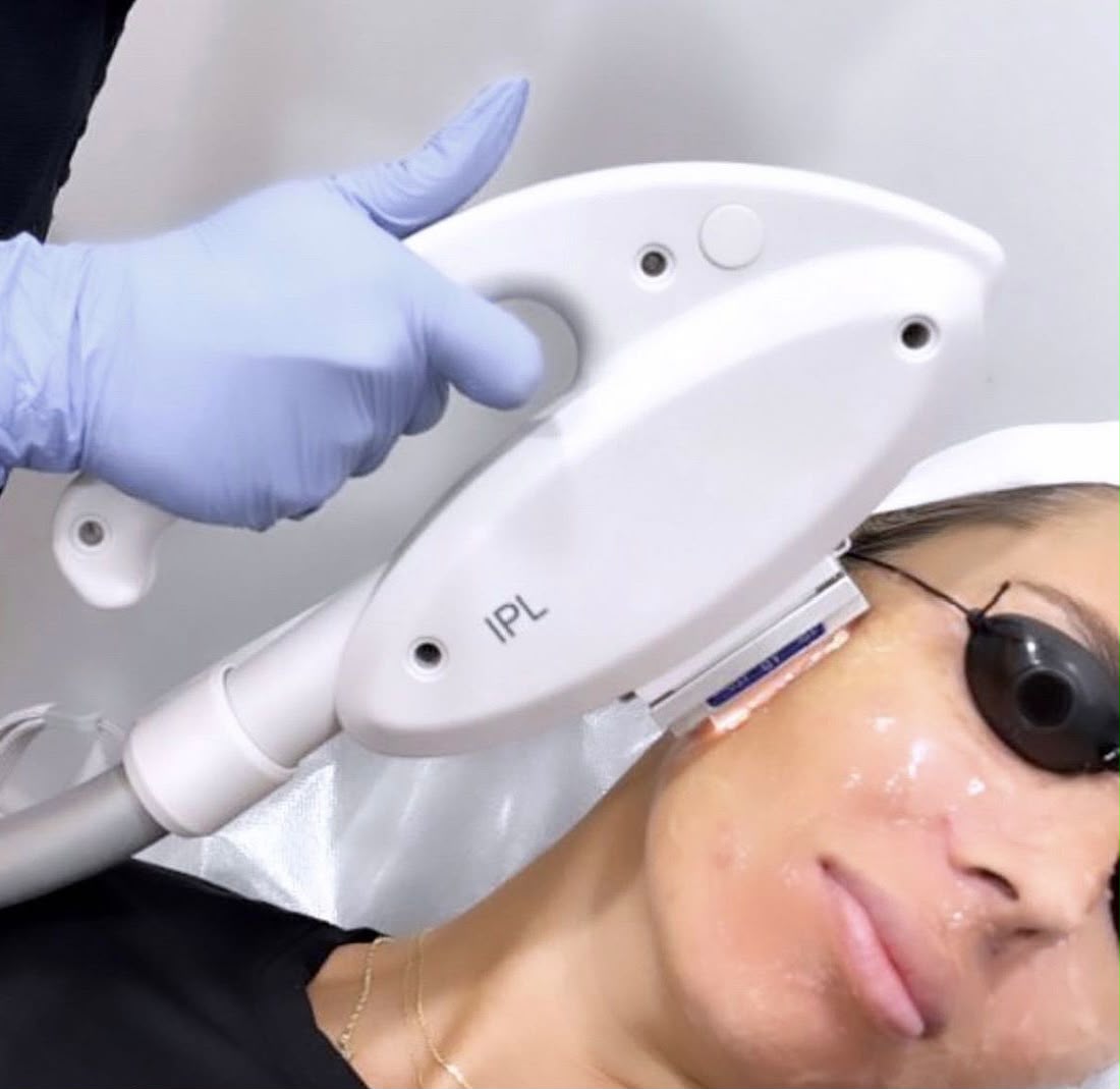 Laser Hair Removal + IPL Skin Rejuvenation training course